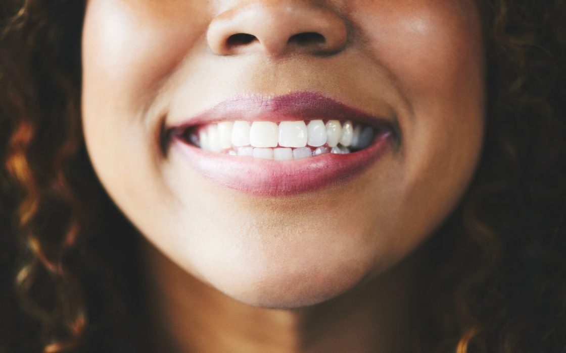 Kvinner smiler - Slik kan du unngå hull i tennene. FOTO